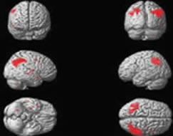 Differential fMRI Study